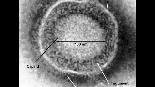 Herpes Simplex Virus Vaccine  Betsy Herold  BBC Radio April 2015 [upl. by Evette]