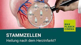 Stammzellen  Heilung nach dem Herzinfarkt [upl. by Petie967]