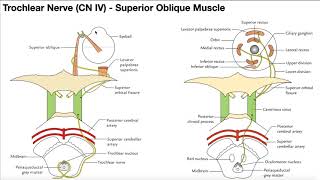 Cranial Nerve 4 Palsy [upl. by Aromas]