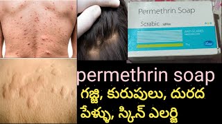 permethrin soap Review in teluguscrabic headlice removal soap usesworking etc [upl. by Hadley837]