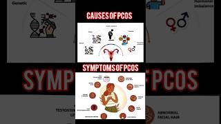 Polycystic Ovarian Syndromepcos pcod pcodtreatment pcosawareness pcosinfertility pcoslifestyle [upl. by Oirazan679]