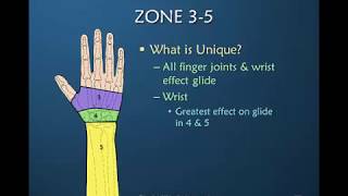 Nuances of Flexor Tendon Rehab Part 12 of 12 Zones 35 amp Review [upl. by Siro203]