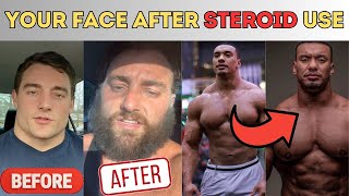 How you look AFTER steroids What steroids does to your face [upl. by Encrata]