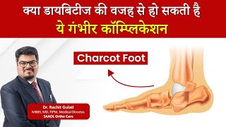 Charcot Foot Symptoms Causes Treatment Complications  Dr Rachit Gulati  SAAOL Ortho Care [upl. by Llednek139]