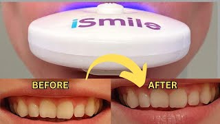 🦷 iSmile Teeth Whitening Kit Review 💡 Safe Fast amp Effective Results [upl. by Osswald]