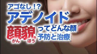 アデノイド顔貌 ってどんな顔？アゴなし？予防と治療【和歌山市 美容歯科】 [upl. by Niwdog]