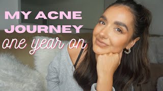 MY JOURNEY FROM ACNE TO CLEAR SKIN  EPIDUO SKINCARE ACNE SCARS [upl. by Ninetta]