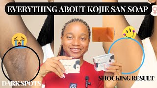 HOW TO EFFECTIVELY USE KOJIE SAN SOAP  Kojie San Soap Detailed Review [upl. by Wesla]