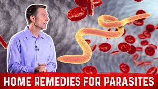 Best Home Remedies for Parasites – Dr Berg [upl. by Alburga]