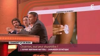 SANTE Faire disparaître ses cicatrices CCVB [upl. by Anaes]