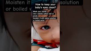 How To Clean Your Baby’s Eyes [upl. by Yniar]