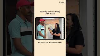 Meet Vilas Udeg whose journey with acne was nothing short of challenging [upl. by Dorrahs]