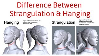 Difference Between Hanging and Strangulation [upl. by Schweitzer]