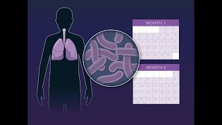 Shorter Course for Tuberculosis Treatment  NEJM [upl. by Garson]