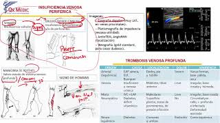 Insuficiencia Venosa y Trombosis Venosa Profunda [upl. by Hans]