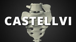 Castellvi classification of lumbosacral transitional vertebrae [upl. by Ygiaf723]