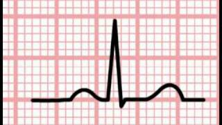 ECG Interpretation  Time and the ECG Section 1 Part 5 [upl. by Hauser]