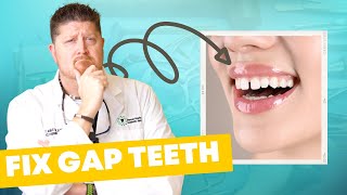 Why You Have GAP TEETH amp How to Fix It [upl. by Johnathon]