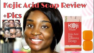 SKIN LIGHTENING SOAP Koji White Kojic Acid Skin Lightening Soap Review  BeautyByAJ [upl. by Ungley241]