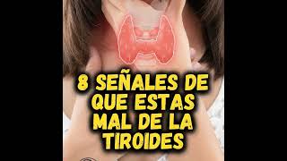 8 Señales de que sufres de TIROIDES 😳 [upl. by Ghassan]