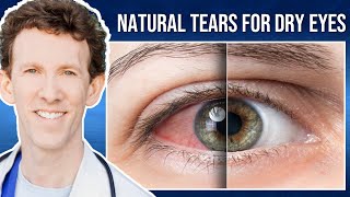 PRP Treatment for Dry Eyes with Dr Scheiner  Ms Dawsons Testimonial [upl. by Drol]