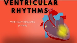 ventricular Rhythms tachycardia amp bradycardia [upl. by Brandwein]