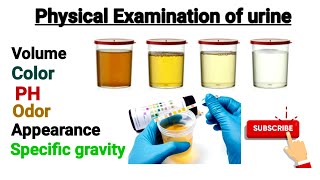 Physical Examination of urine part 2  PH and Specific gravity of urine [upl. by Colfin]