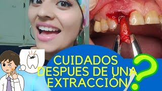 CUIDADOS después de una EXTRACCIÓN DENTAL [upl. by Kincaid]