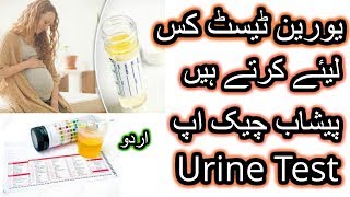 how is urine test And What Is Benefit of This Test [upl. by Oicirtap992]