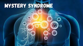 Newfound autoimmune syndrome tied to COVID19 can trigger deadly lung scarring [upl. by Hsuk]