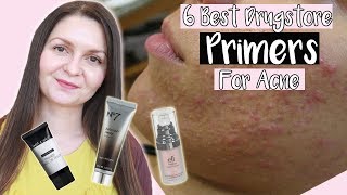 Best Drugstore Primers For Acne Prone Skin 2019  Noncomedogenic Primers [upl. by Isyed]