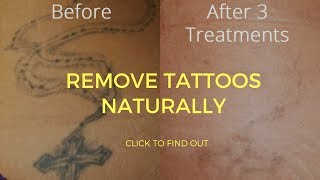 How To Remove Tattoos Naturally [upl. by Akinej539]