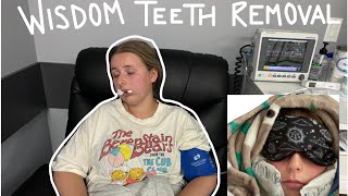 My Wisdom Teeth Removal  Rachel Christine Martin [upl. by Eillac]