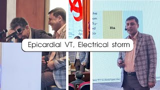 Epicardial Vt Electrical Storm [upl. by Garceau]