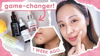 4 BEST BRIGHTENING SERUMS vitamin c acne amp hyperpigmentation [upl. by Adnamal]