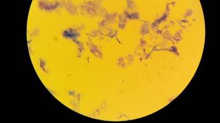 Clostridium tetani [upl. by Haeli]