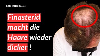 Folge 17 So macht Finasterid die Haare wieder dicker [upl. by Gosney]