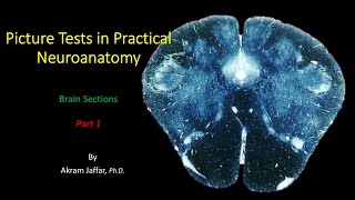 Picture Test in Neuroanatomy Brain Sections 1 [upl. by Hgierb589]