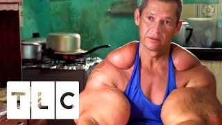 Bodybuilders Inject Muscles With Oil  Real Life Hulks [upl. by Timmy699]