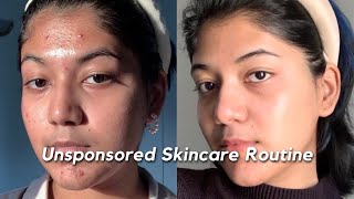 How I got rid of my ACNE SCARS amp TEXTURE  My Unsponsored Skincare Routine 🧴🫧🧖 [upl. by Annemarie936]