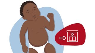 How to Identify Chest Indrawing [upl. by Ida]