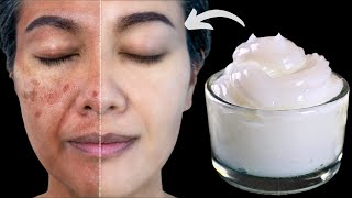 Milk and cornstarch will make you a 16yearold girl Cornstarch Face Mask Secret AntiAging Trick [upl. by Nezam497]