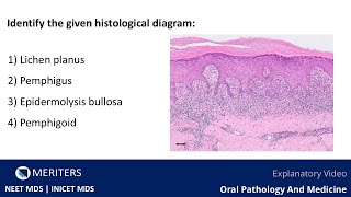 NEET MDS  INICET  OPM  Skin And Vesiculobullous Lesions  Explanatory Video  MERITERS [upl. by Miles284]