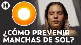 Adiós a las manchas en la piel causas tratamiento y cómo prevenirlas [upl. by Onitsuaf]