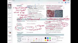 Systematic amyloidosis Pathology 21  First Aid USMLE Step 1 in UrduHindi [upl. by Delgado]