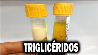 BIOSÍNTESIS DE TRIGLICÉRIDOS explicada Paso a Paso [upl. by Glaab]