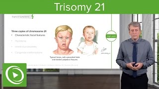 Trisomy 21 Down Syndrome Introduction – Pediatrics  Lecturio [upl. by Anivla929]