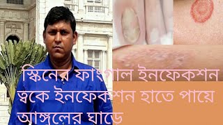 Grisovin FP tablet use in বাংলা2021 [upl. by Ahsem]