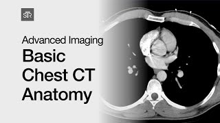 Advanced Imaging Basic Chest CT Anatomy [upl. by Soloman]