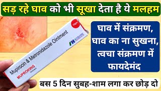 जल्दी से जानलो Muproking Ointment Kis Kaam Aati Hai वरना ✅ Medicine For Cuts And Wounds Mupirocin [upl. by Assenov581]